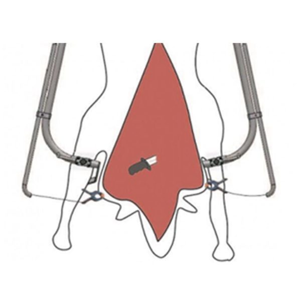 Termet Carcass Spreader & Clip Air